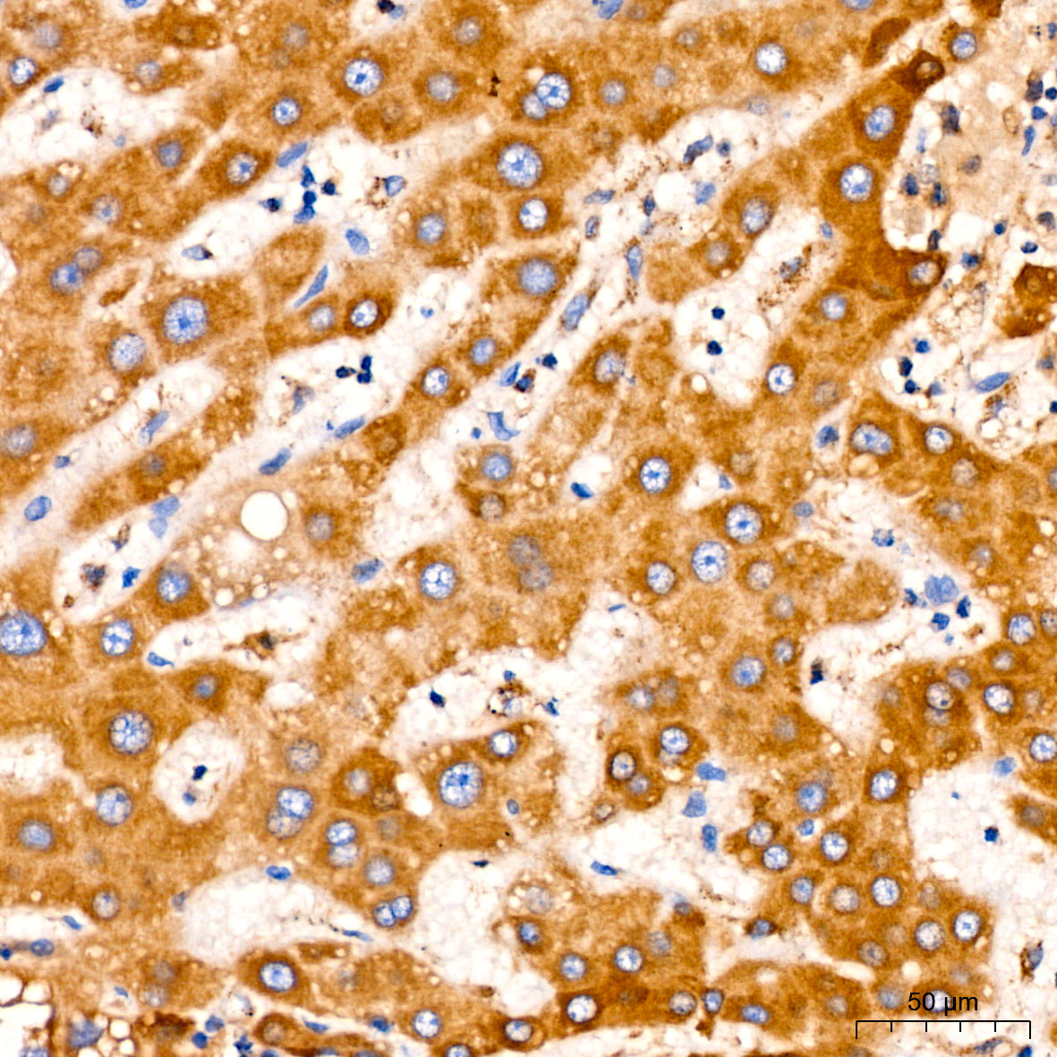 PITRM1 Rabbit mAb