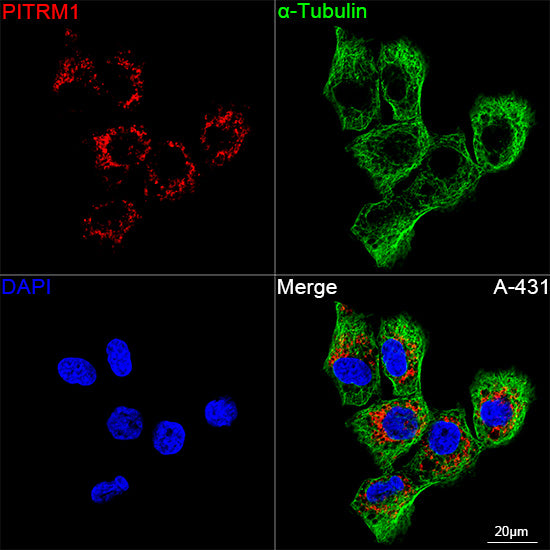PITRM1 Rabbit mAb