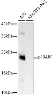 CDKN2A/p19ARF Rabbit mAb