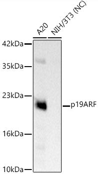 CDKN2A/p19ARF Rabbit mAb