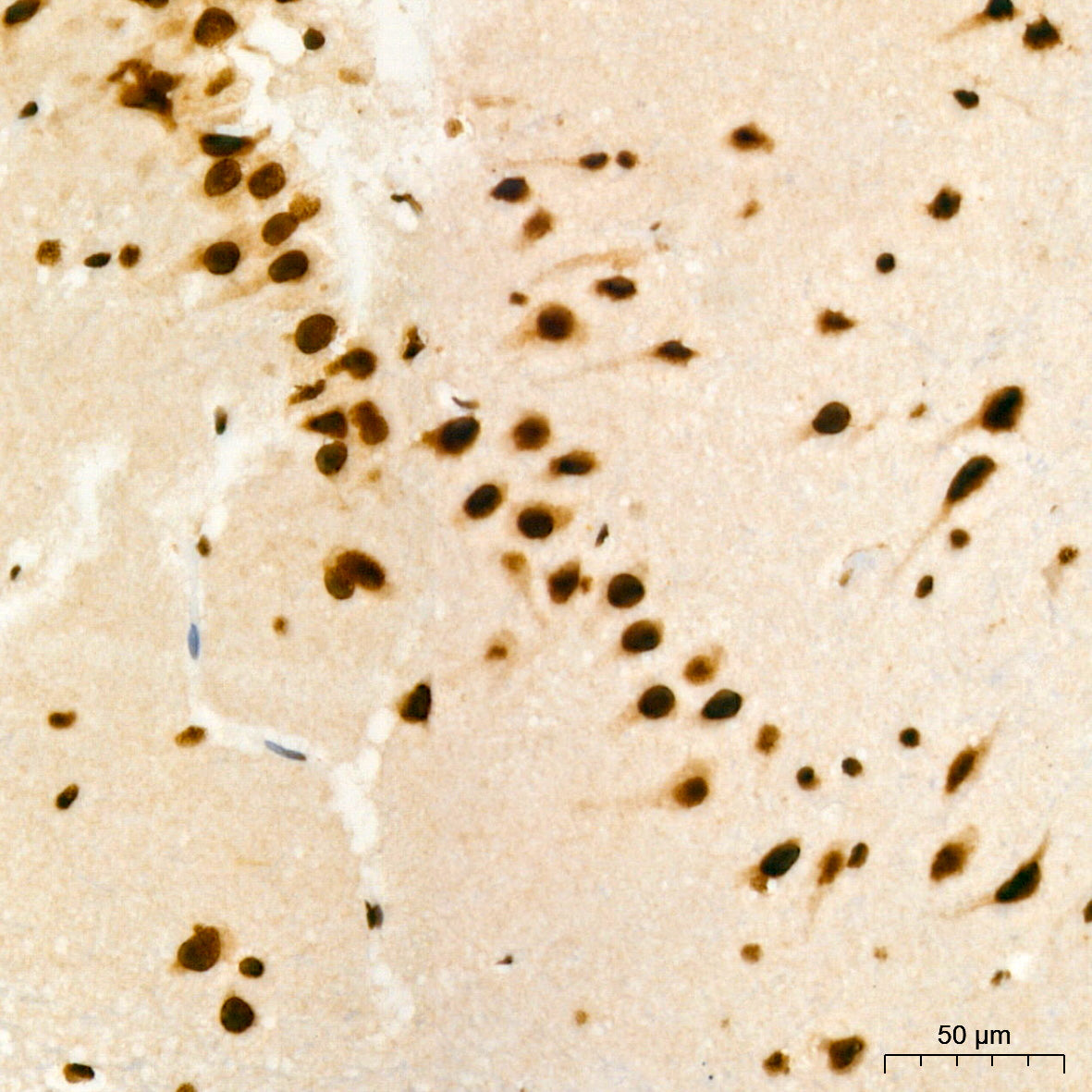 CDKN2A/p19ARF Rabbit mAb