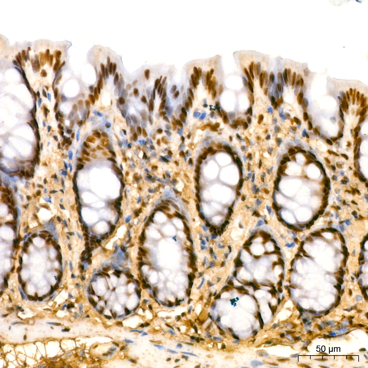 CDKN2A/p19ARF Rabbit mAb