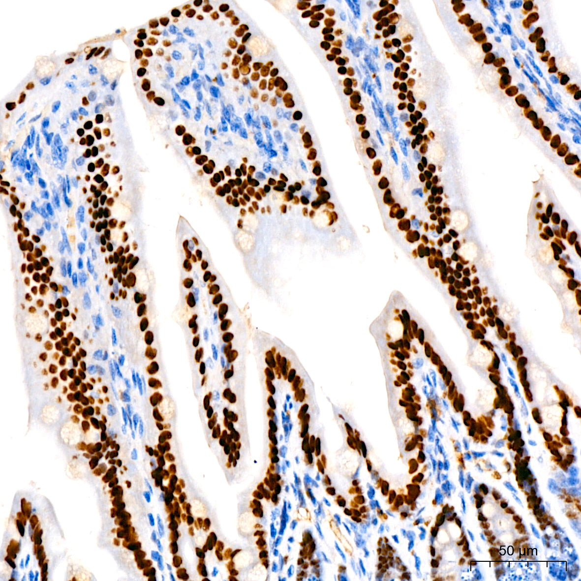 HNF4G Rabbit mAb
