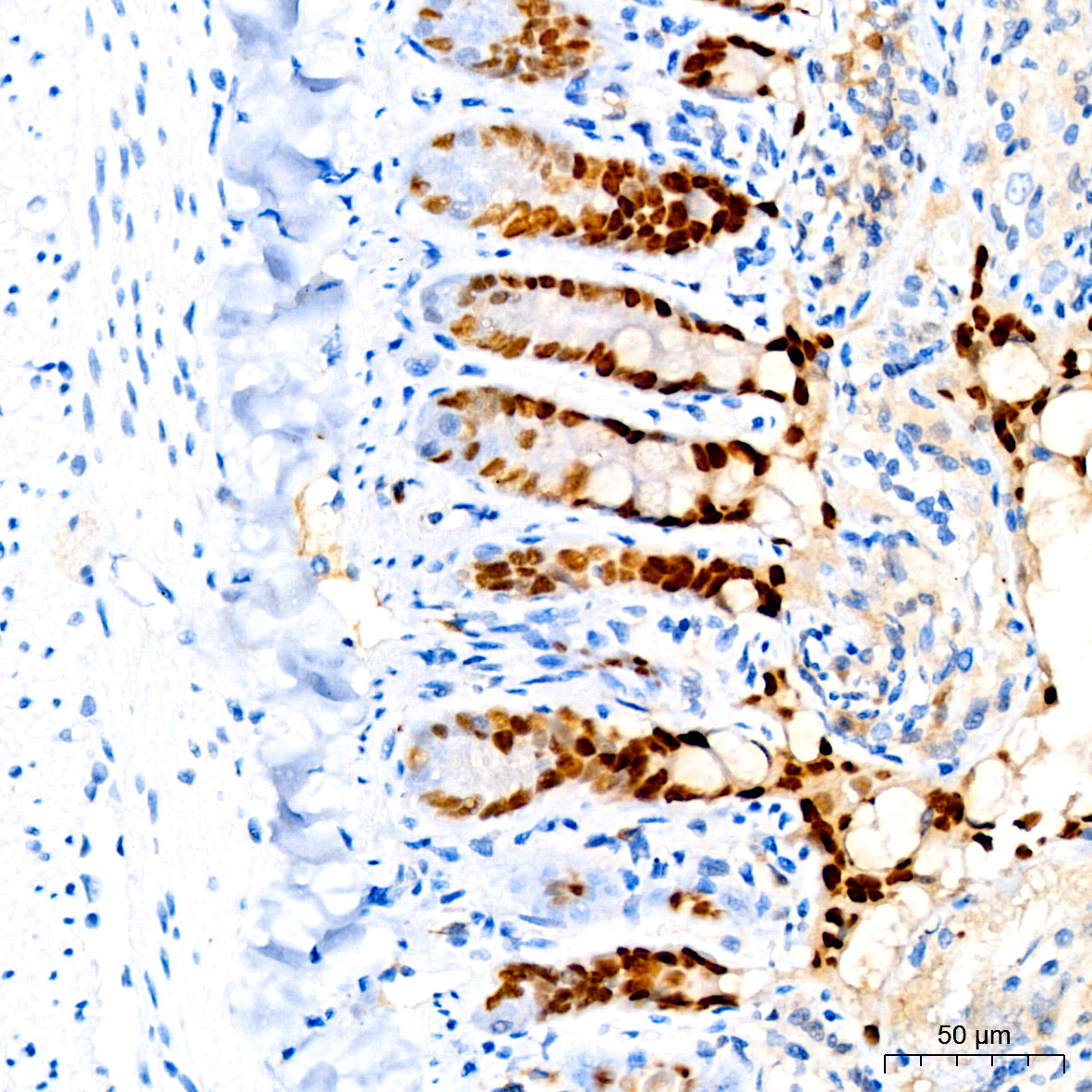HNF4G Rabbit mAb