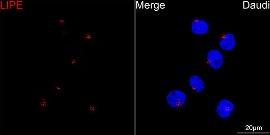 HSL/LIPE Rabbit mAb