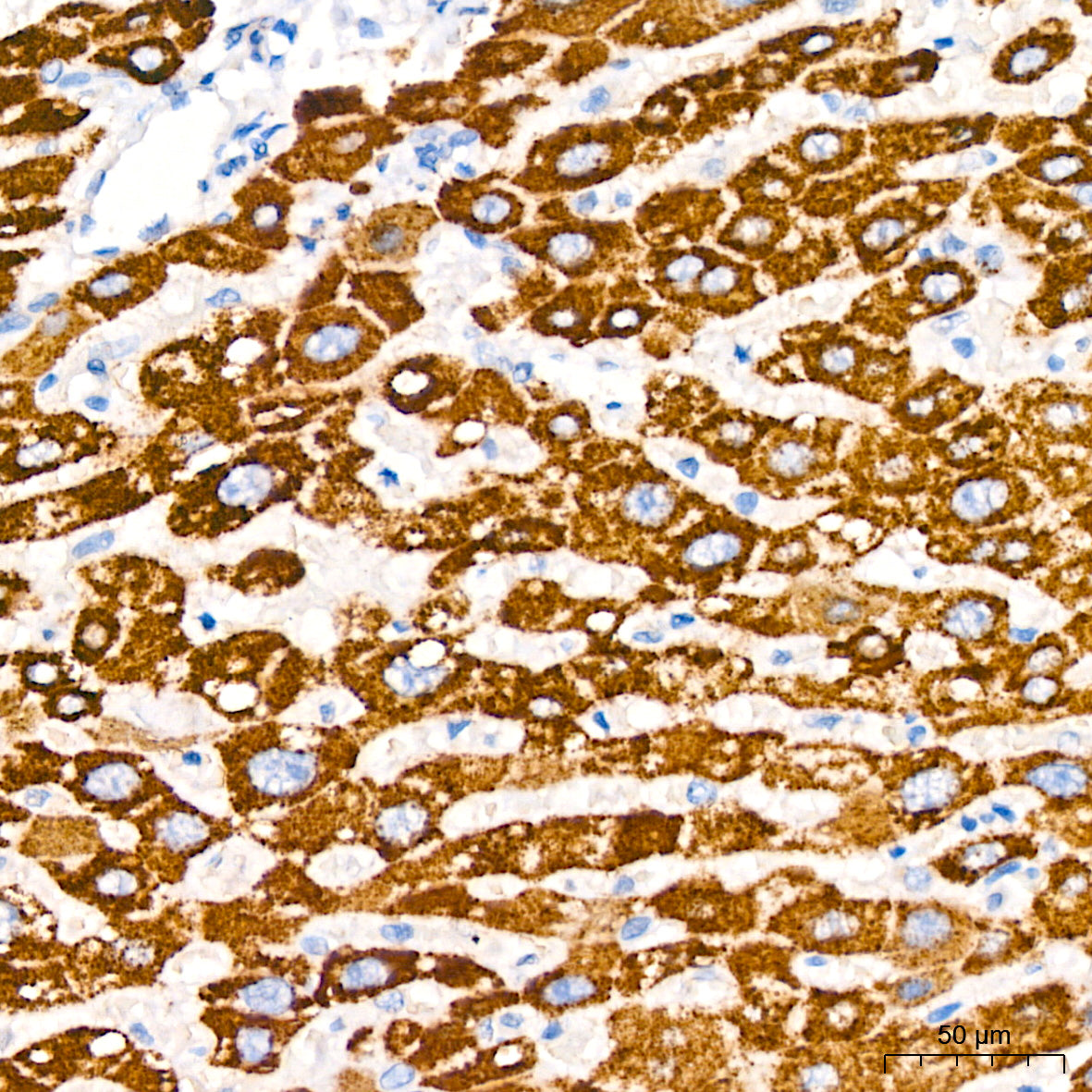 Megalin/LRP2 Rabbit mAb
