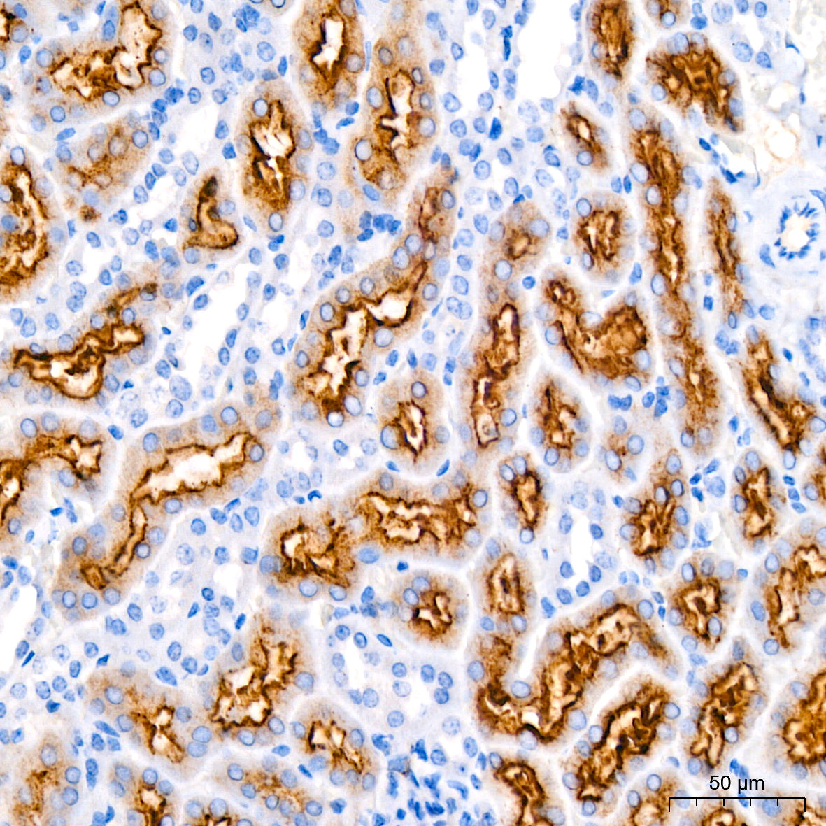 Megalin/LRP2 Rabbit mAb