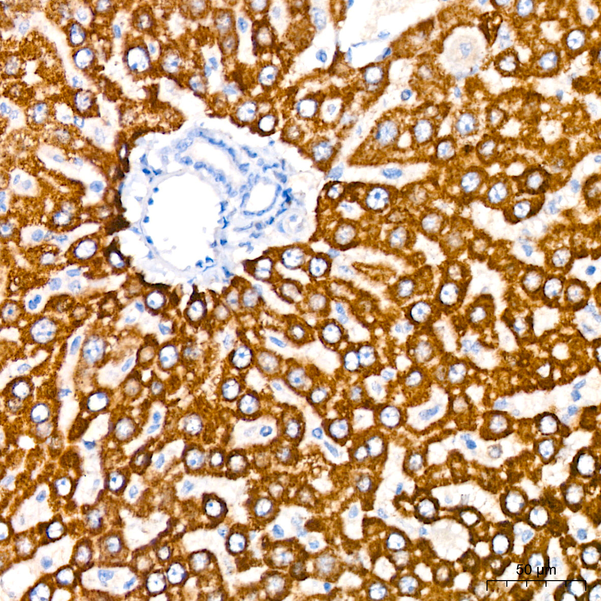Megalin/LRP2 Rabbit mAb
