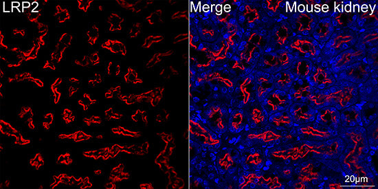 Megalin/LRP2 Rabbit mAb