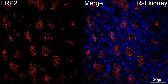 Megalin/LRP2 Rabbit mAb