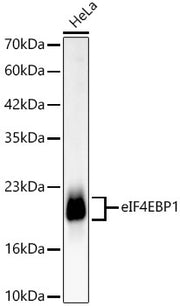 [KD Validated] eIF4EBP1 Rabbit mAb