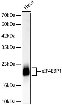 [KD Validated] eIF4EBP1 Rabbit mAb
