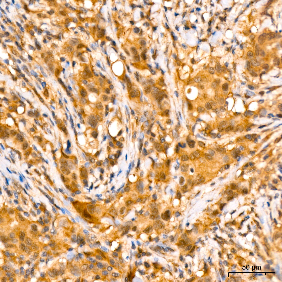 [KD Validated] eIF4EBP1 Rabbit mAb