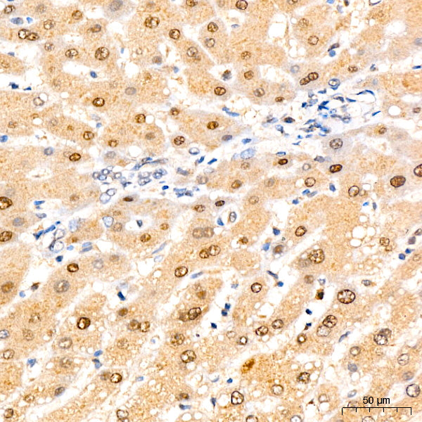 [KD Validated] eIF4EBP1 Rabbit mAb