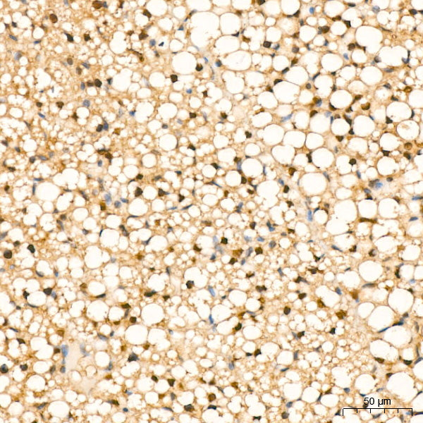 [KD Validated] eIF4EBP1 Rabbit mAb