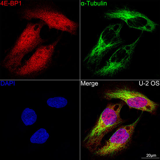 [KD Validated] eIF4EBP1 Rabbit mAb