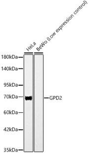 GPD2 Rabbit mAb