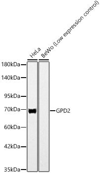 GPD2 Rabbit mAb