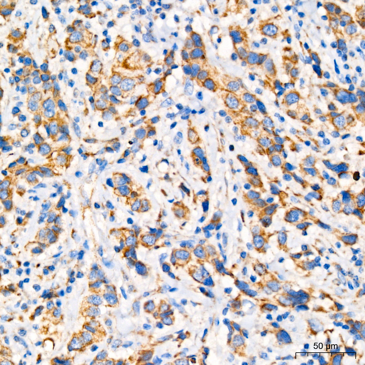 GPD2 Rabbit mAb