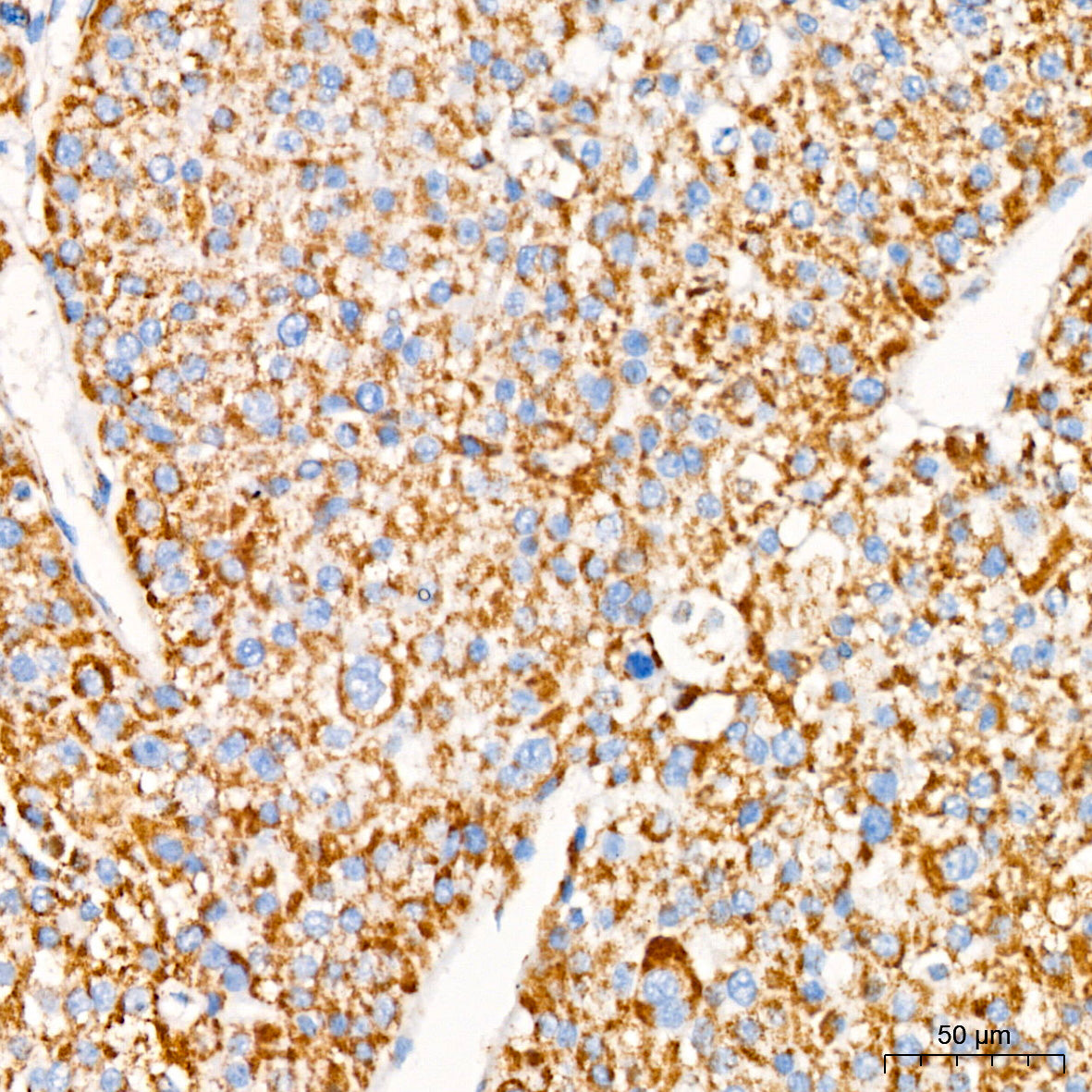 GPD2 Rabbit mAb