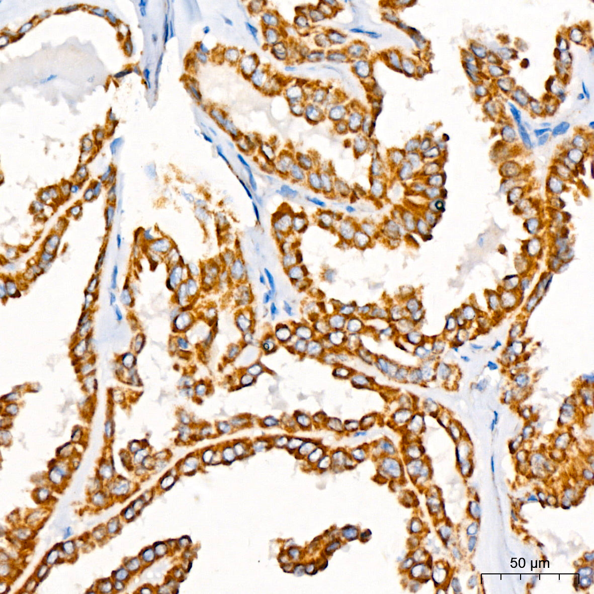 GPD2 Rabbit mAb