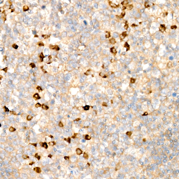 Human Kappa Light Chain Rabbit mAb