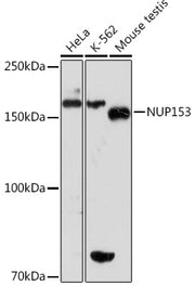 NUP153 Rabbit mAb
