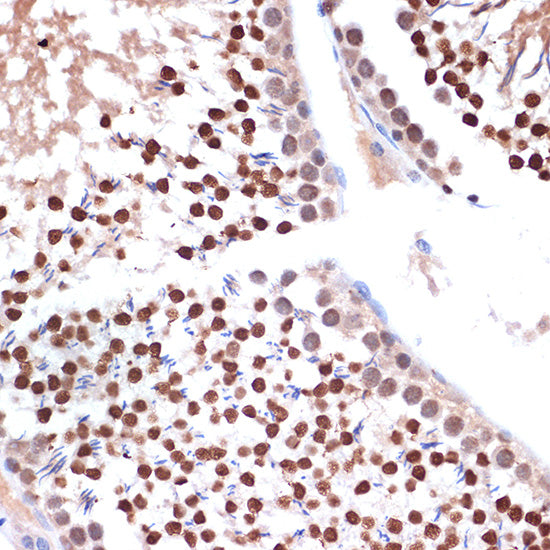 NUP153 Rabbit mAb
