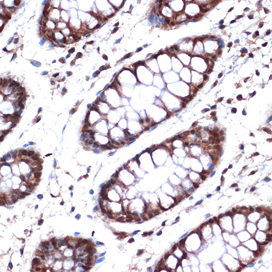 NUP153 Rabbit mAb