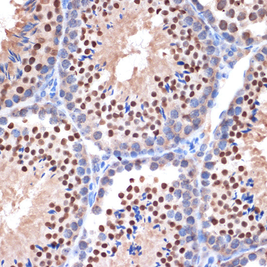 NUP153 Rabbit mAb
