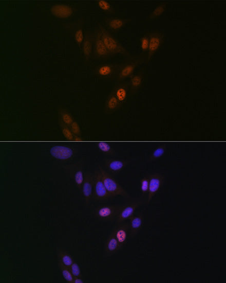 NUP153 Rabbit mAb