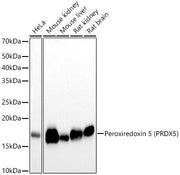 [KO Validated] Peroxiredoxin 5 (PRDX5) Rabbit mAb