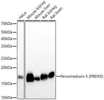 [KO Validated] Peroxiredoxin 5 (PRDX5) Rabbit mAb