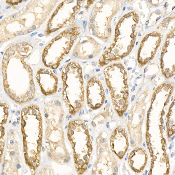 [KO Validated] Peroxiredoxin 5 (PRDX5) Rabbit mAb