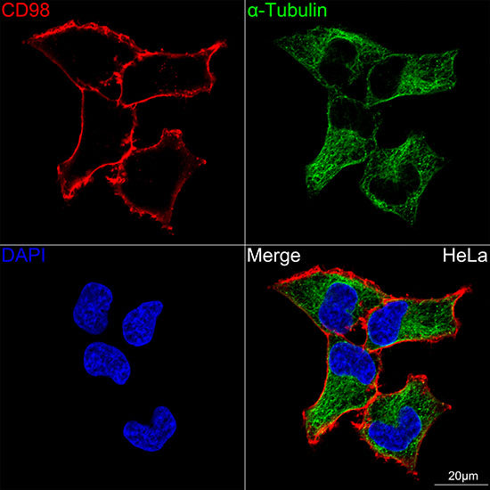 [KD Validated] CD98/SLC3A2 Rabbit mAb