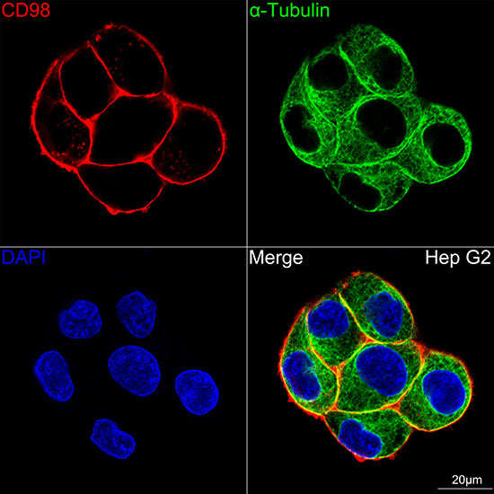 [KD Validated] CD98/SLC3A2 Rabbit mAb