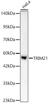 [KO Validated] TRIM21/SS-A Rabbit mAb