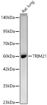 [KO Validated] TRIM21/SS-A Rabbit mAb