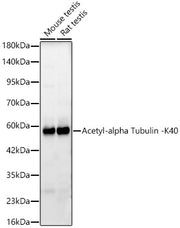 Acetyl-alpha Tubulin -K40 Rabbit mAb