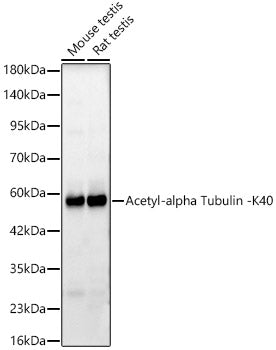 Acetyl-alpha Tubulin -K40 Rabbit mAb