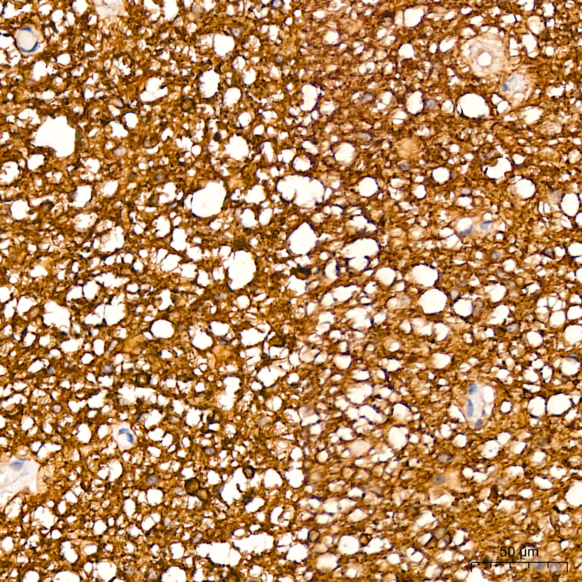 Acetyl-alpha Tubulin -K40 Rabbit mAb