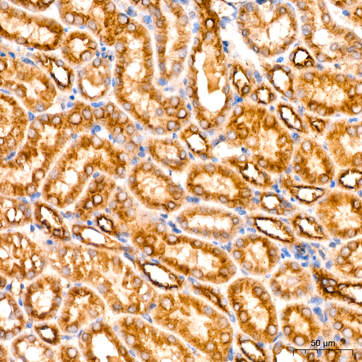 Acetyl-alpha Tubulin -K40 Rabbit mAb