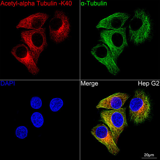 Acetyl-alpha Tubulin -K40 Rabbit mAb