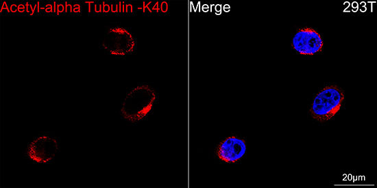 Acetyl-alpha Tubulin -K40 Rabbit mAb