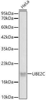 UBE2C Rabbit mAb