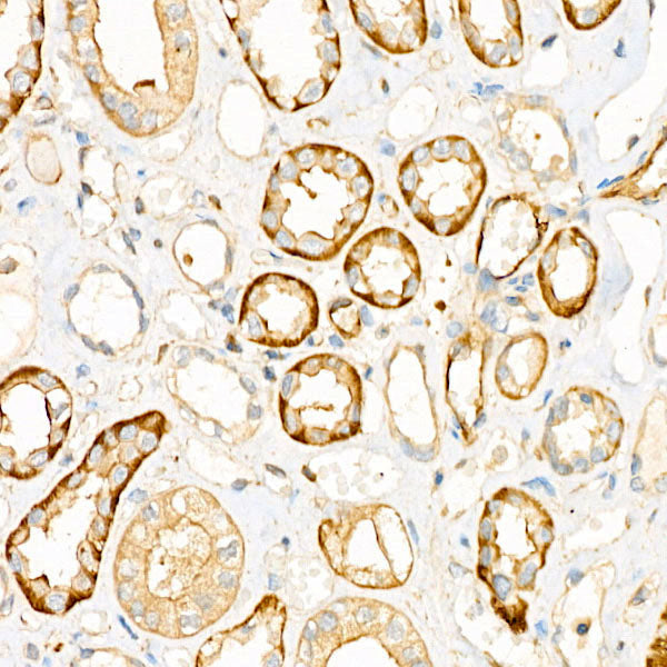 UBE2C Rabbit mAb