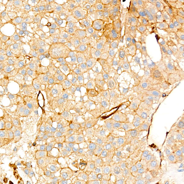 UBE2C Rabbit mAb