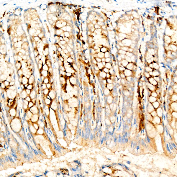 UBE2C Rabbit mAb
