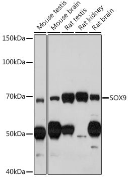 SOX9 Rabbit pAb