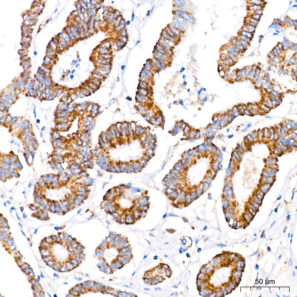 MTCO1 Rabbit mAb